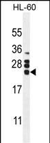 WB - CSF2 Antibody (Center) AP10690c